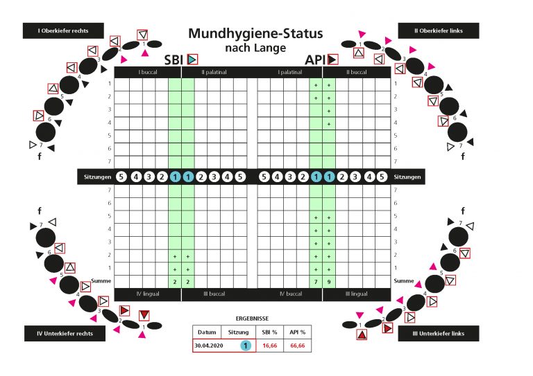 API SBI Grafik - Recall Magazin