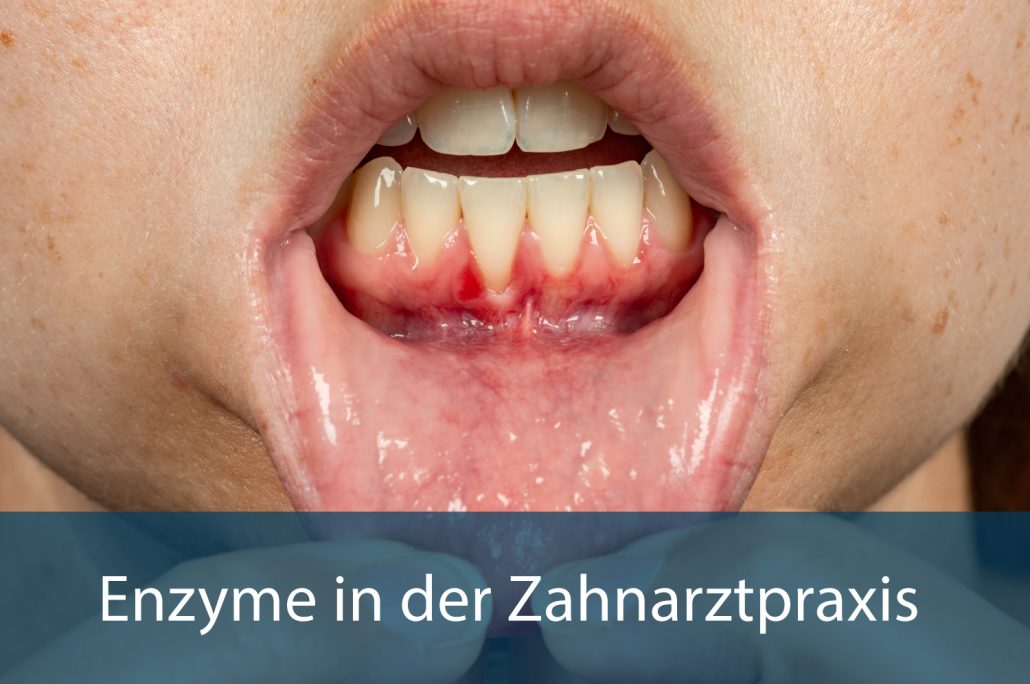 Dental Baromter Enzyme 750x498px 2022