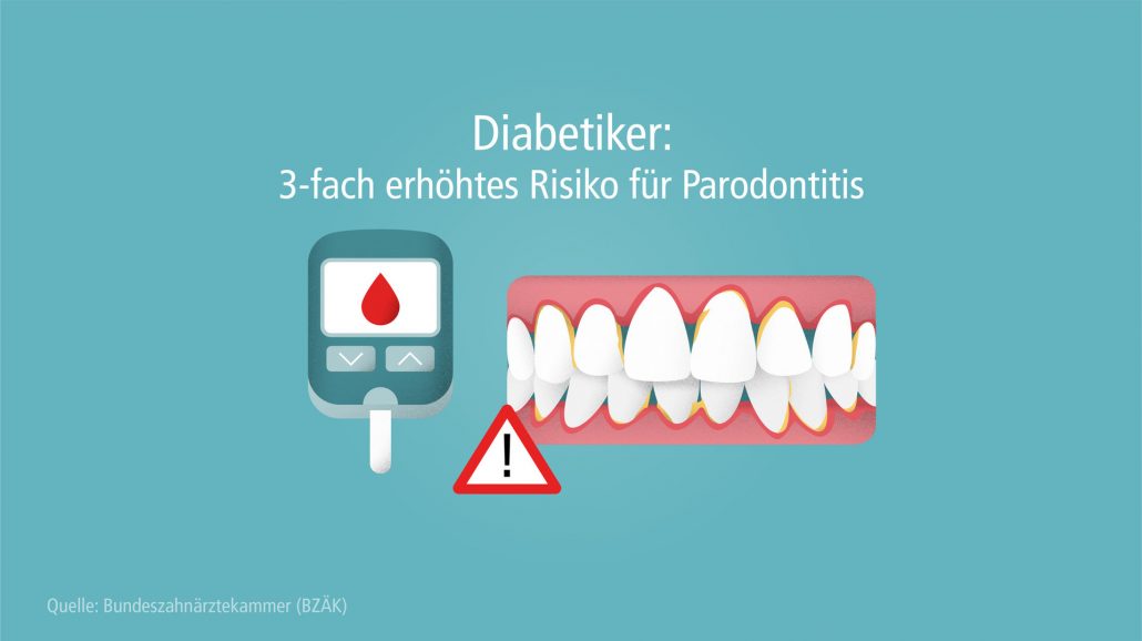 Menschen mit Diabetes haben ein dreifach erhöhtes Risiko für eine Parodontitis, früher auch als Parodontose bezeichnet. Um Entzündungen aber auch Karies vorzubeugen, sollten Diabetiker Zähne und Zahnfleisch gut pflegen.
