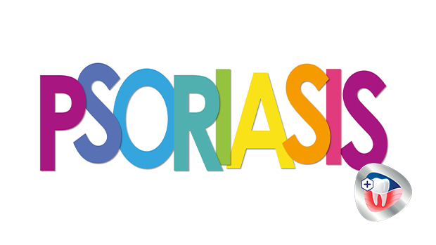 Bidirektionale Zusammenhänge zwischen Parodontitis und Psoriasis